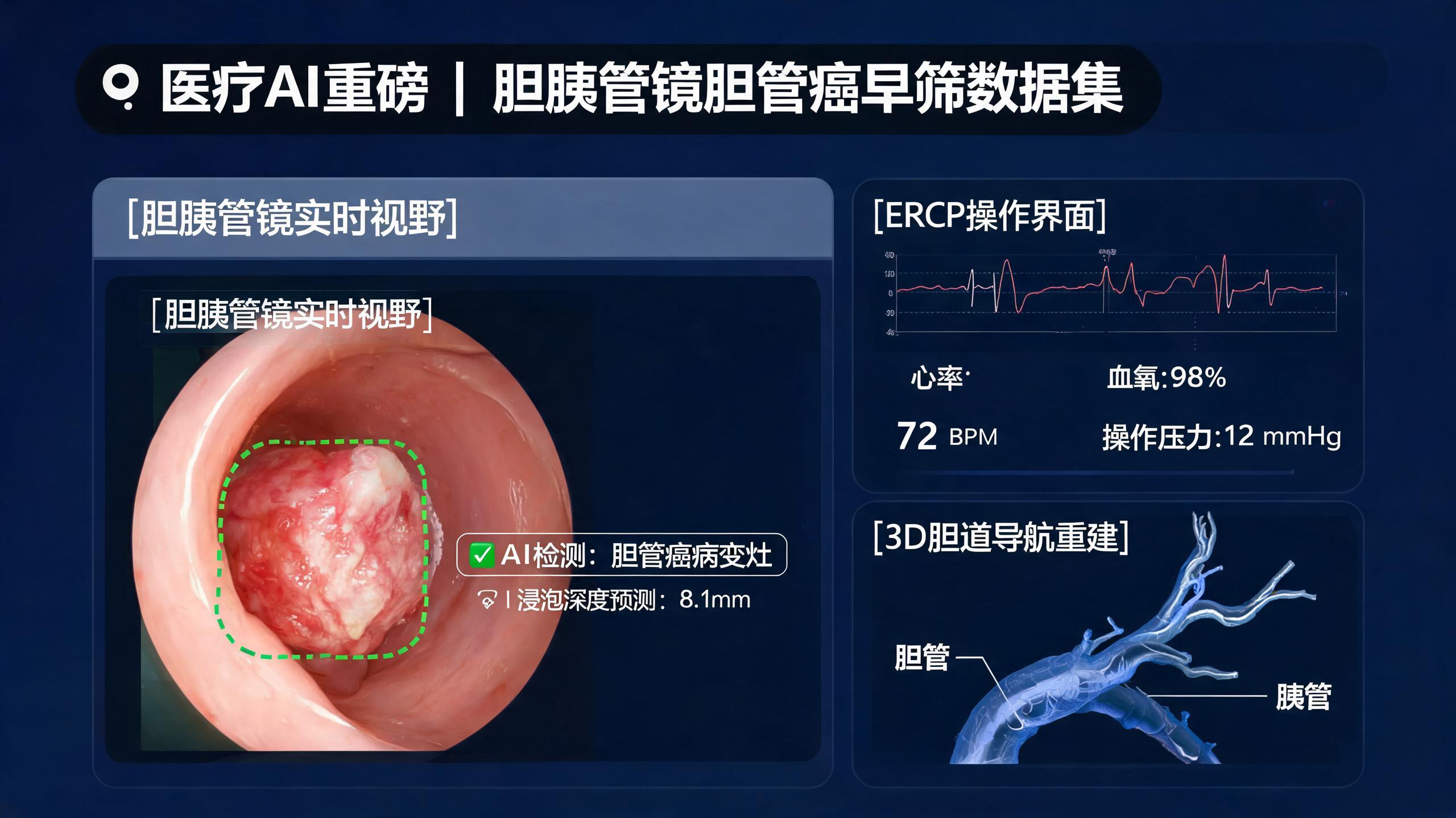 胆胰疾病AI的罕见病突围：10万例胆胰管镜数据与少样本学习前沿
