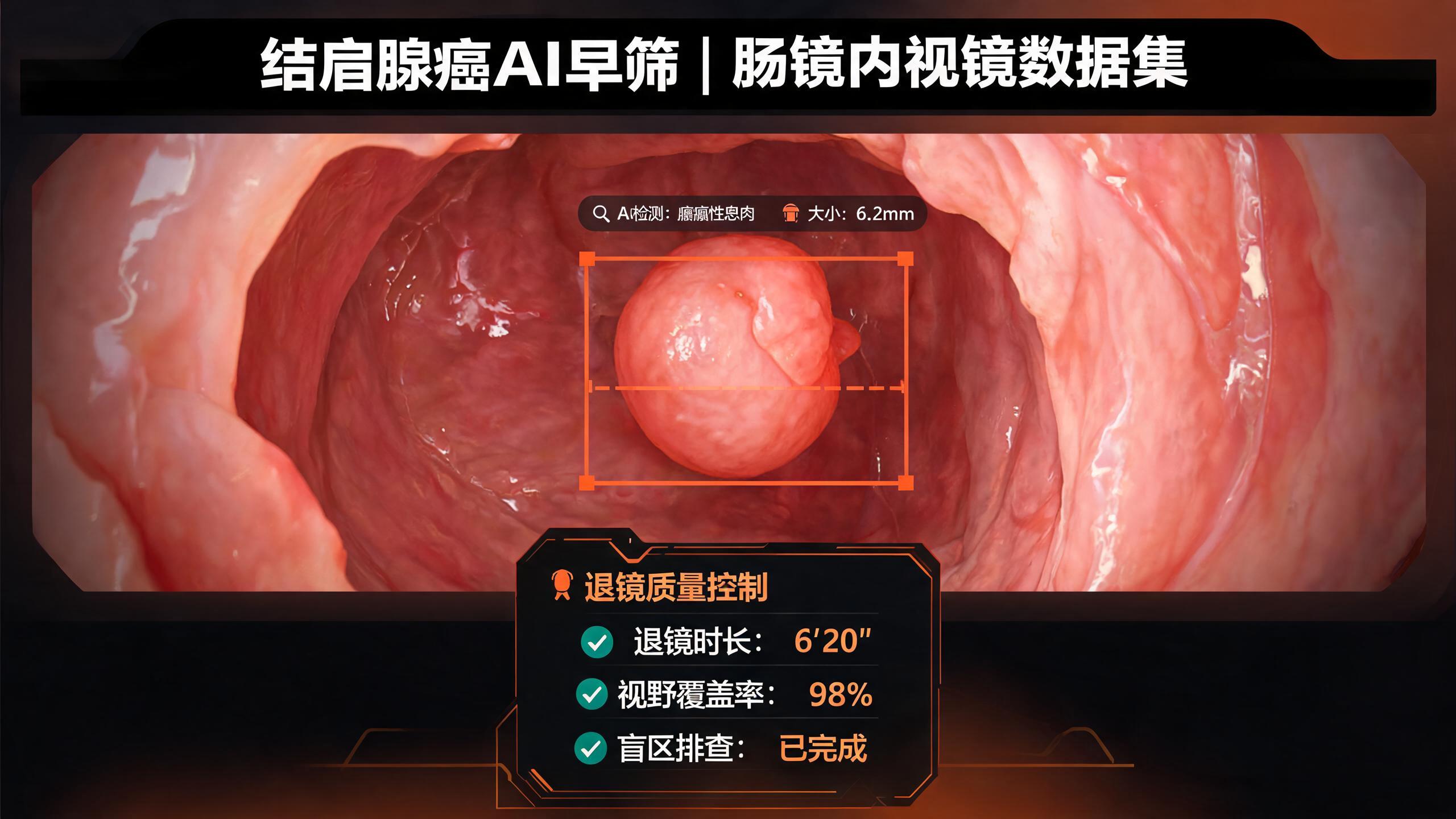 结直肠癌早筛的AI拐点：20万例肠镜视频数据与退镜质量控制的标准化实践